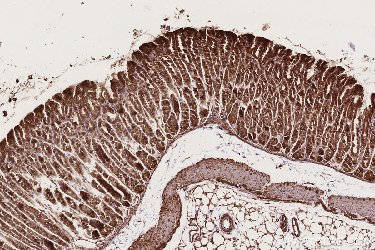 IHC staining of mouse stomach using 11363-1-AP IHC staining of mouse stomach using 11363-1-AP