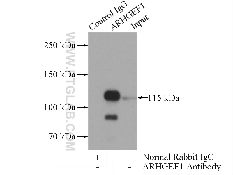 IP experiment of HEK-293 using 11363-1-AP