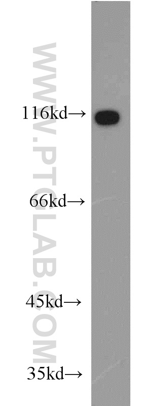 WB analysis of HEK-293 using 11363-1-AP