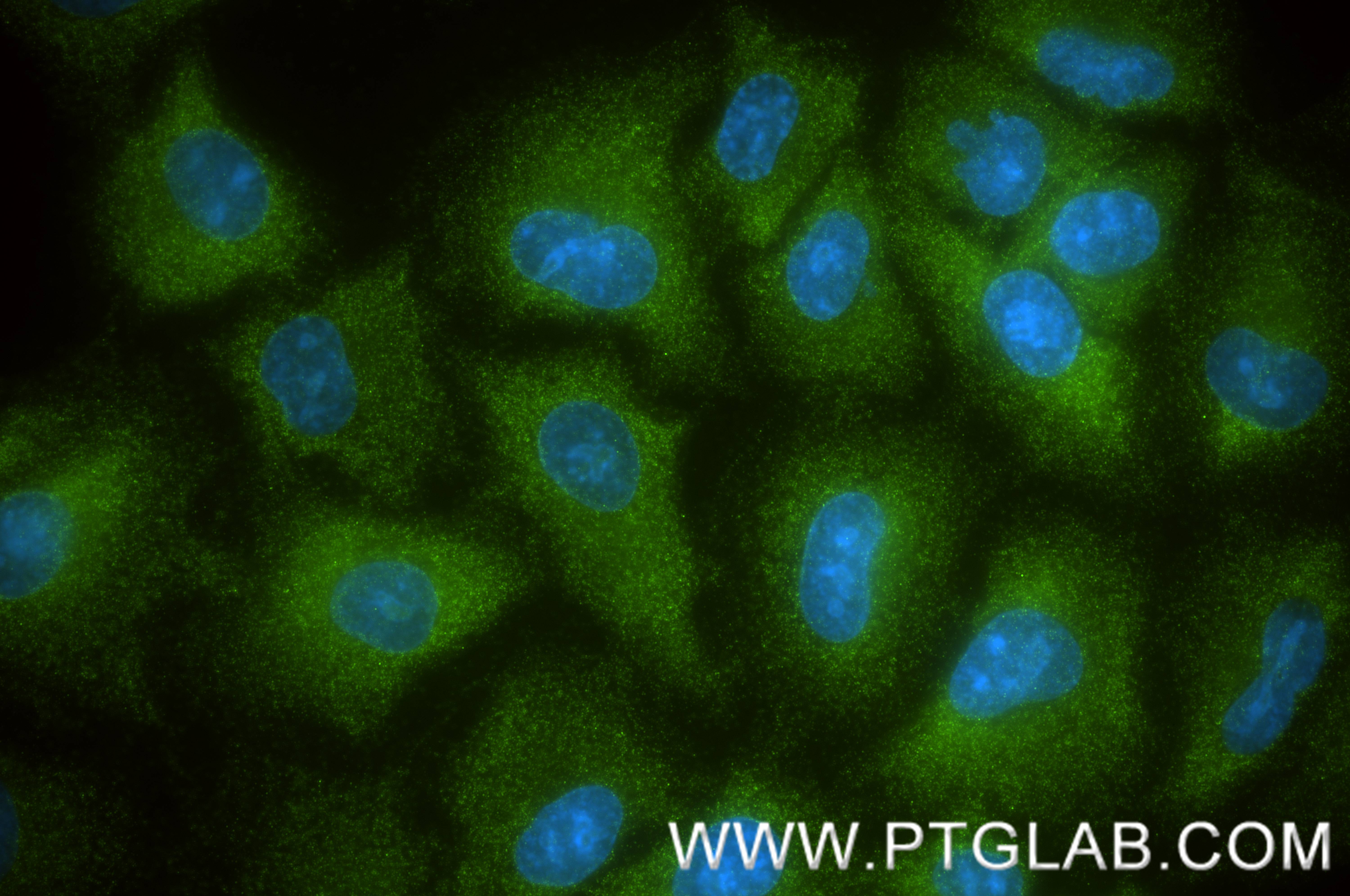 IF Staining of A549 using 88129-1-RR IF Staining of A549 using 88129-1-RR