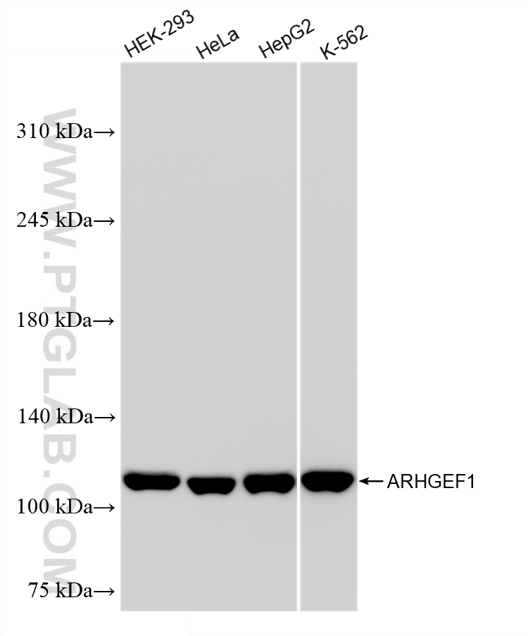 WB analysis using 88129-1-RR WB analysis using 88129-1-RR