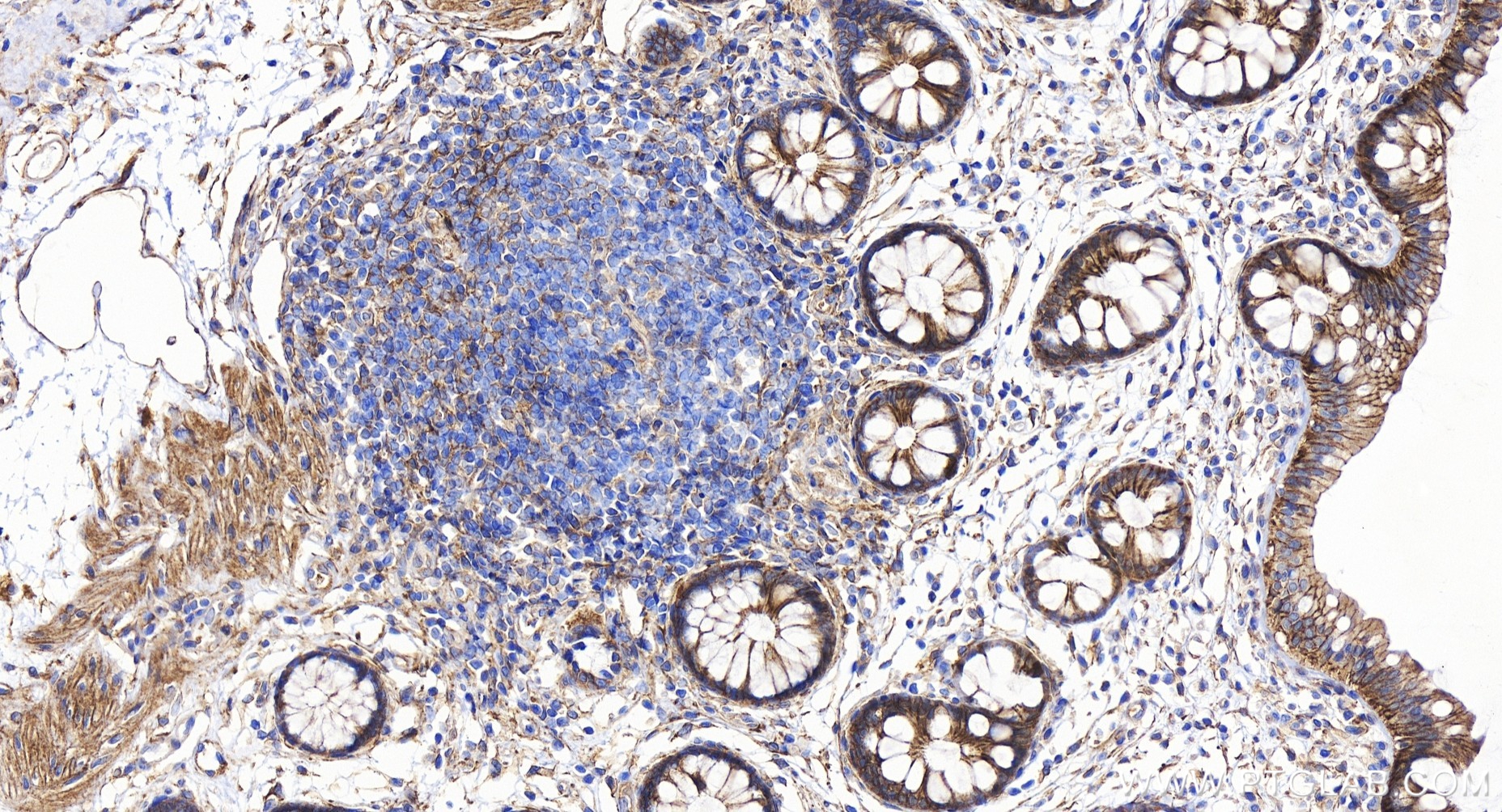 IHC staining of human colon using 84149-1-RR