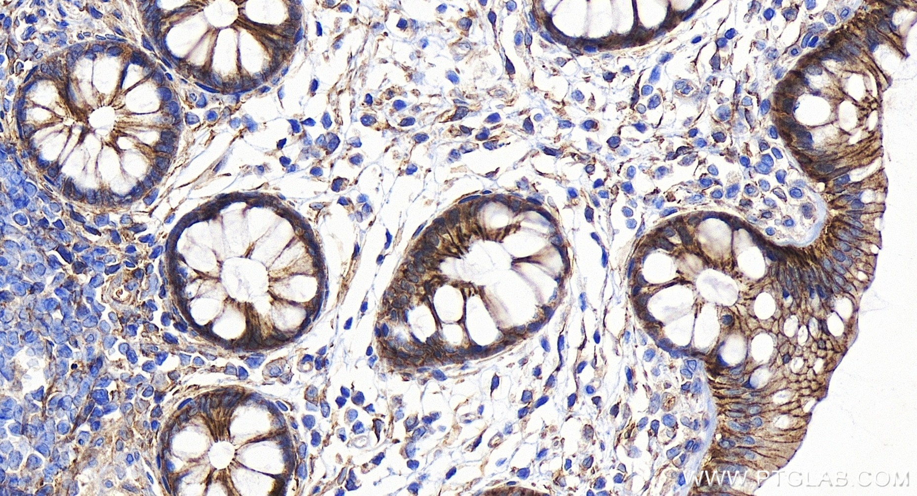IHC staining of human colon using 84149-1-RR