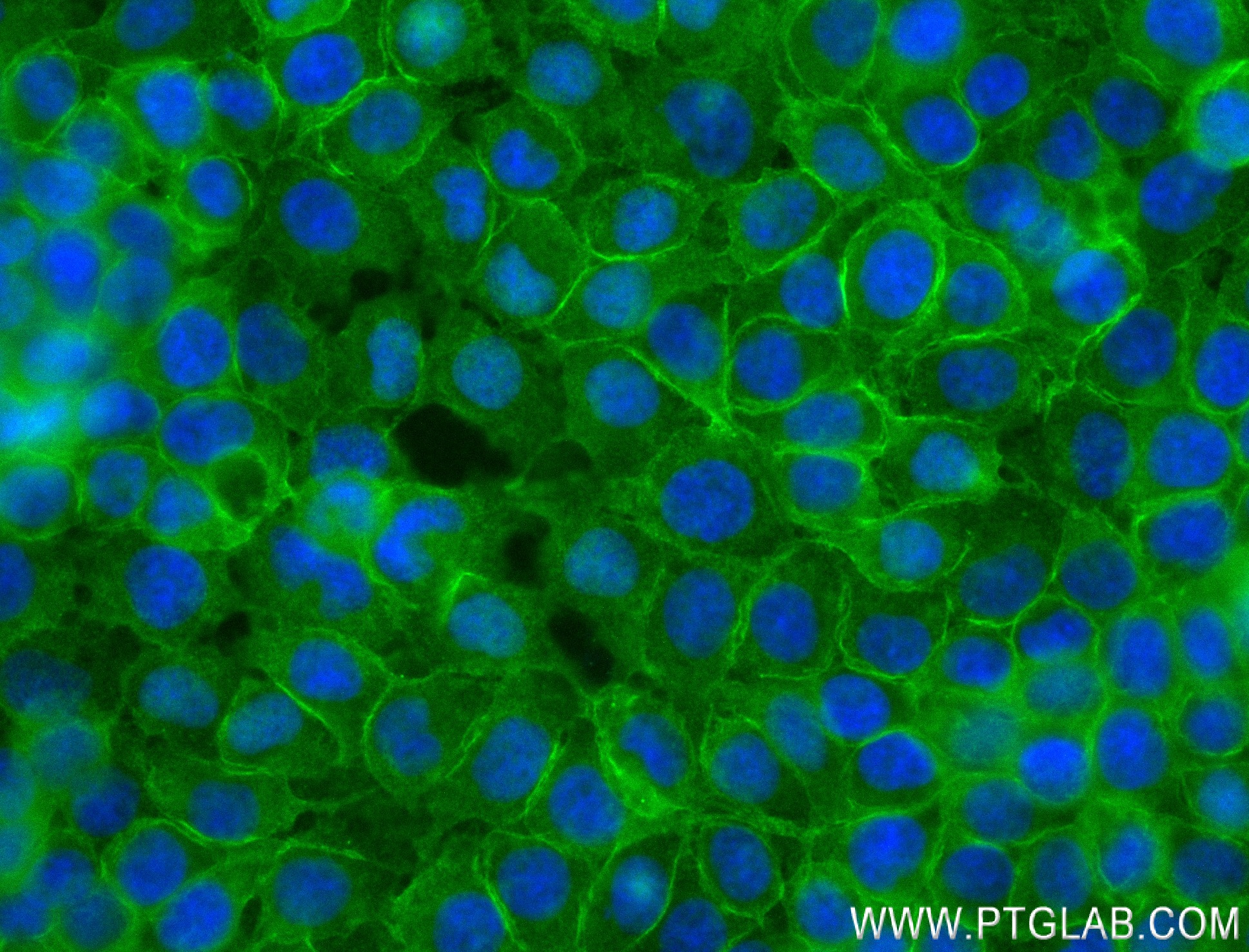 IF Staining of HuH-7 using 84149-1-RR