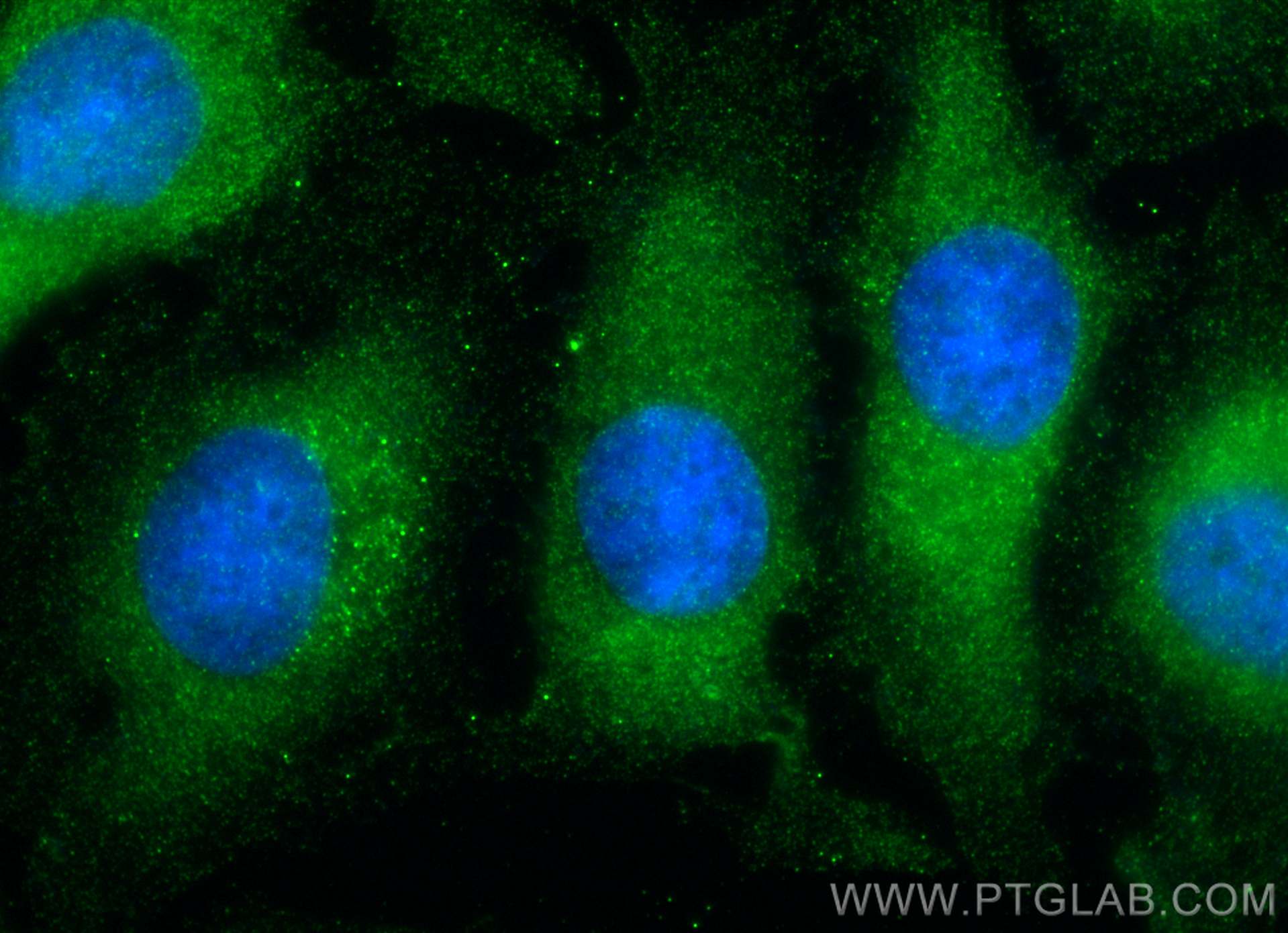 IF Staining of HeLa using 67975-1-Ig