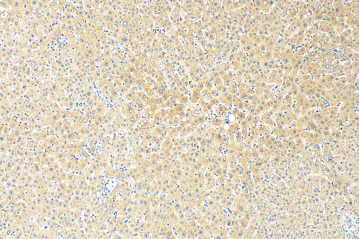 IHC staining of human liver using 20021-1-AP