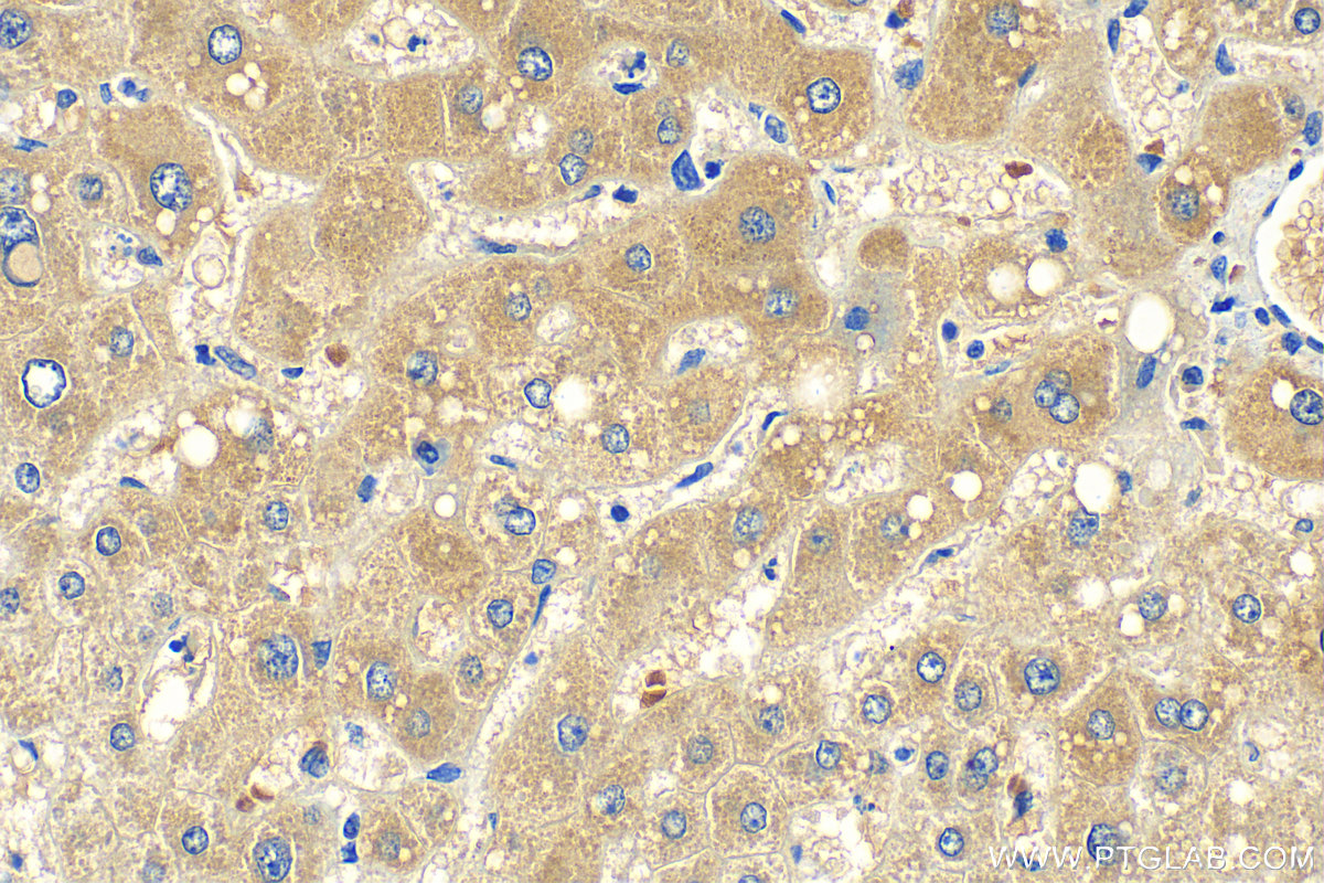 IHC staining of human liver using 20021-1-AP
