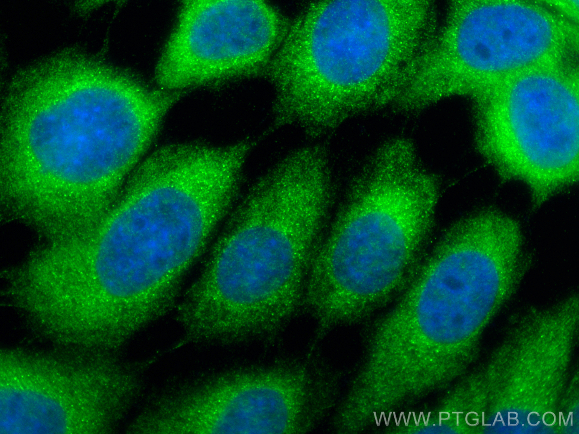 IF Staining of A431 using 11243-1-AP
