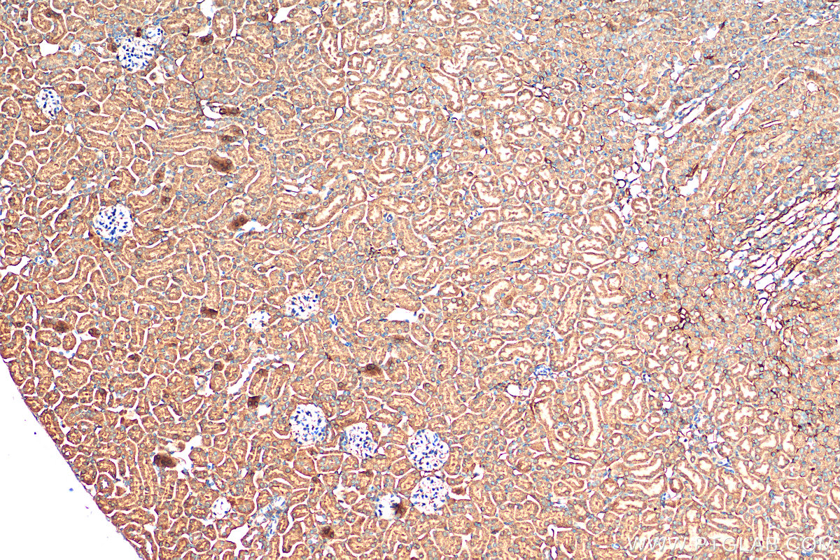 IHC staining of mouse kidney using 11243-1-AP