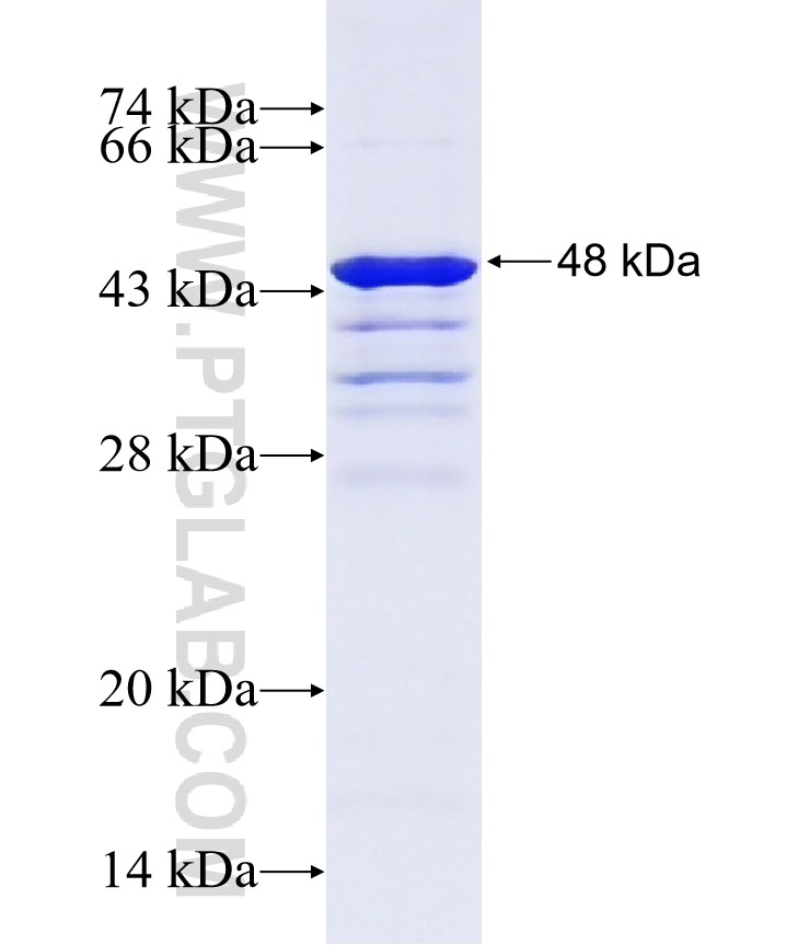GEF-H1 fusion protein Ag13378 SDS-PAGE GEF-H1 fusion protein Ag13378 SDS-PAGE