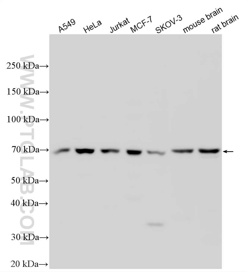 WB analysis using 55213-1-AP (same clone as 55213-1-PBS)