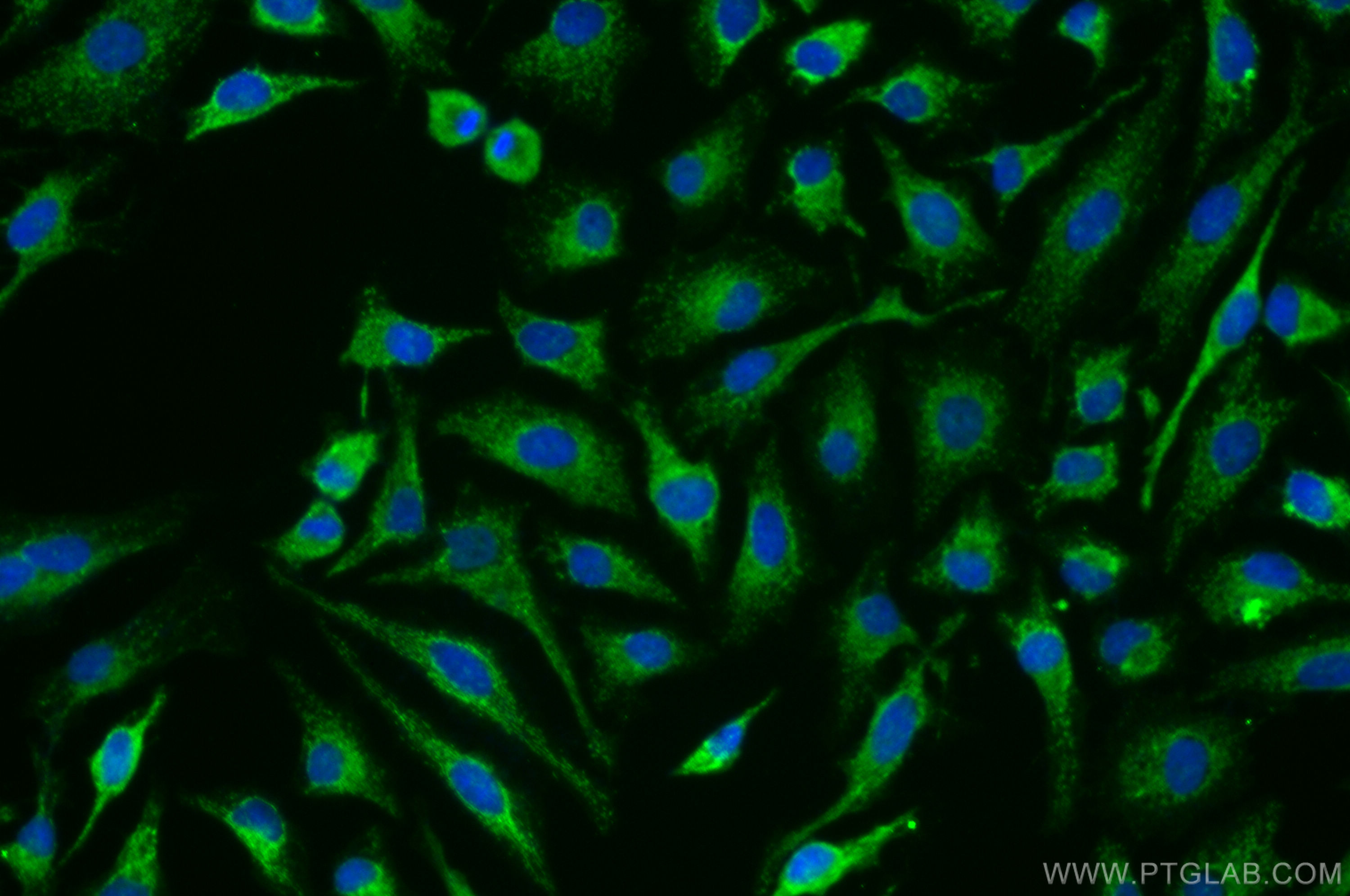 IF Staining of HeLa using 11379-1-AP