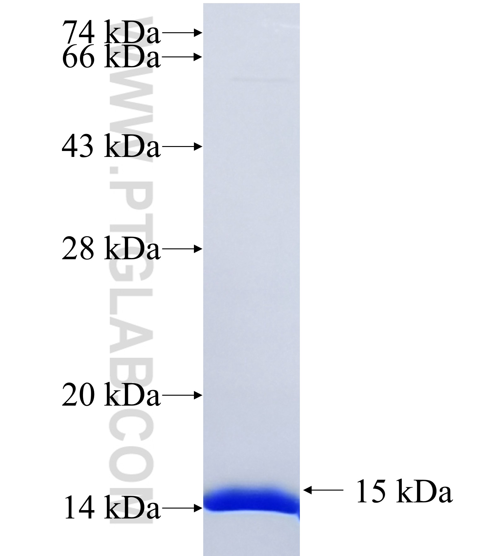 ARHGEF6 fusion protein Ag37216 SDS-PAGE ARHGEF6 fusion protein Ag37216 SDS-PAGE