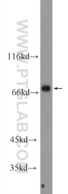 ARHGEF7 Polyclonal antibody