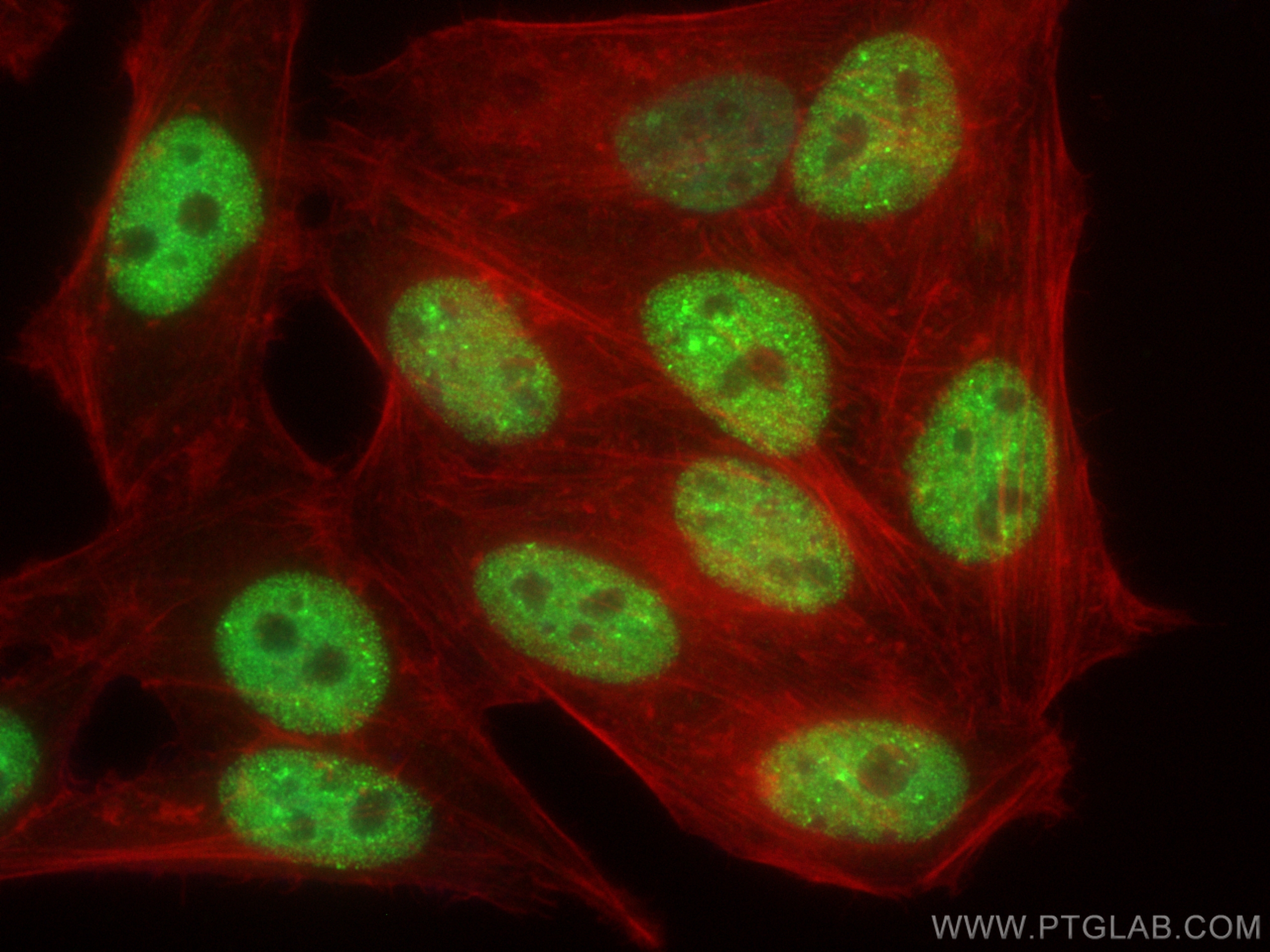 IF Staining of HepG2 using 82979-1-RR