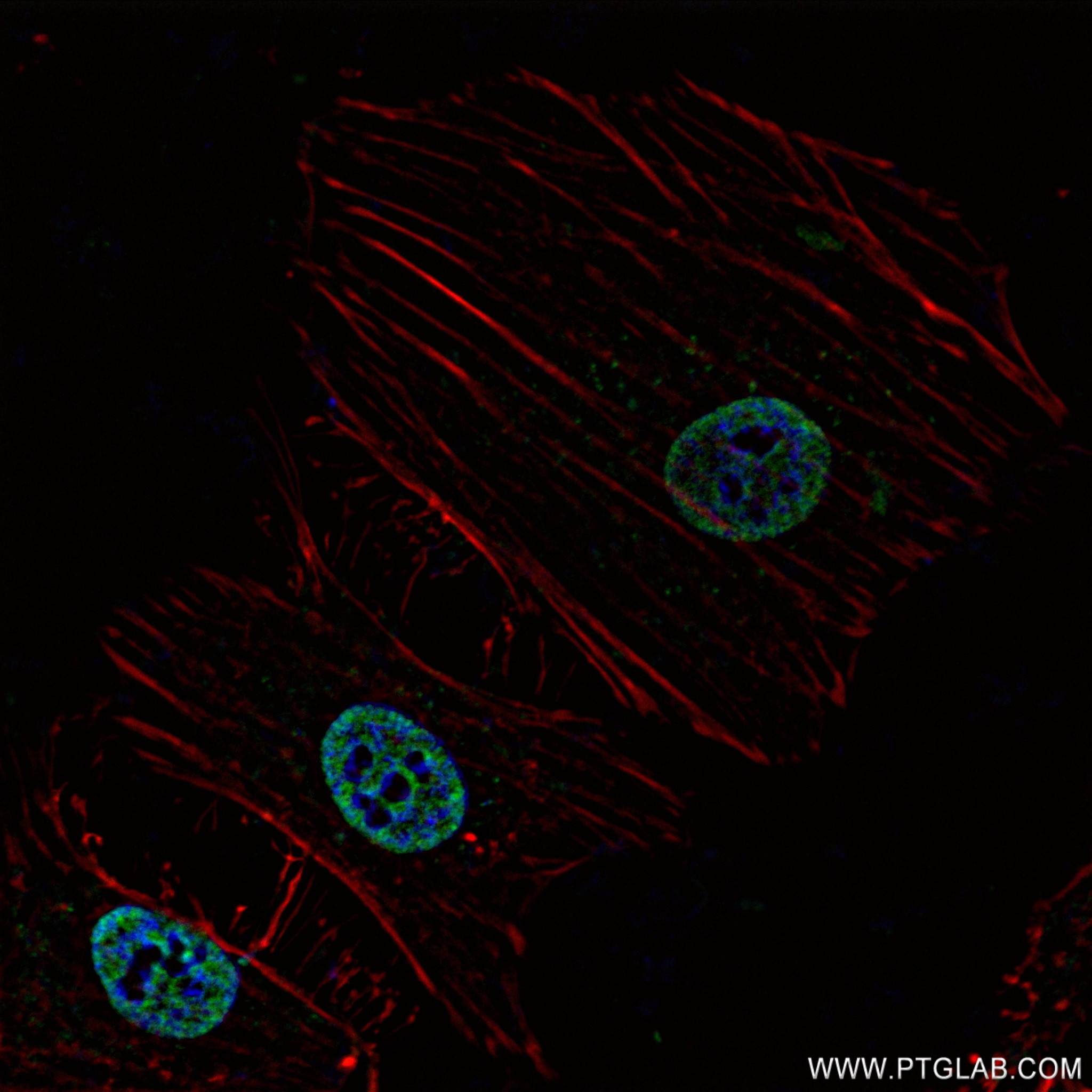 IF Staining of HeLa using 82979-6-RR (same clone as 82979-6-PBS)