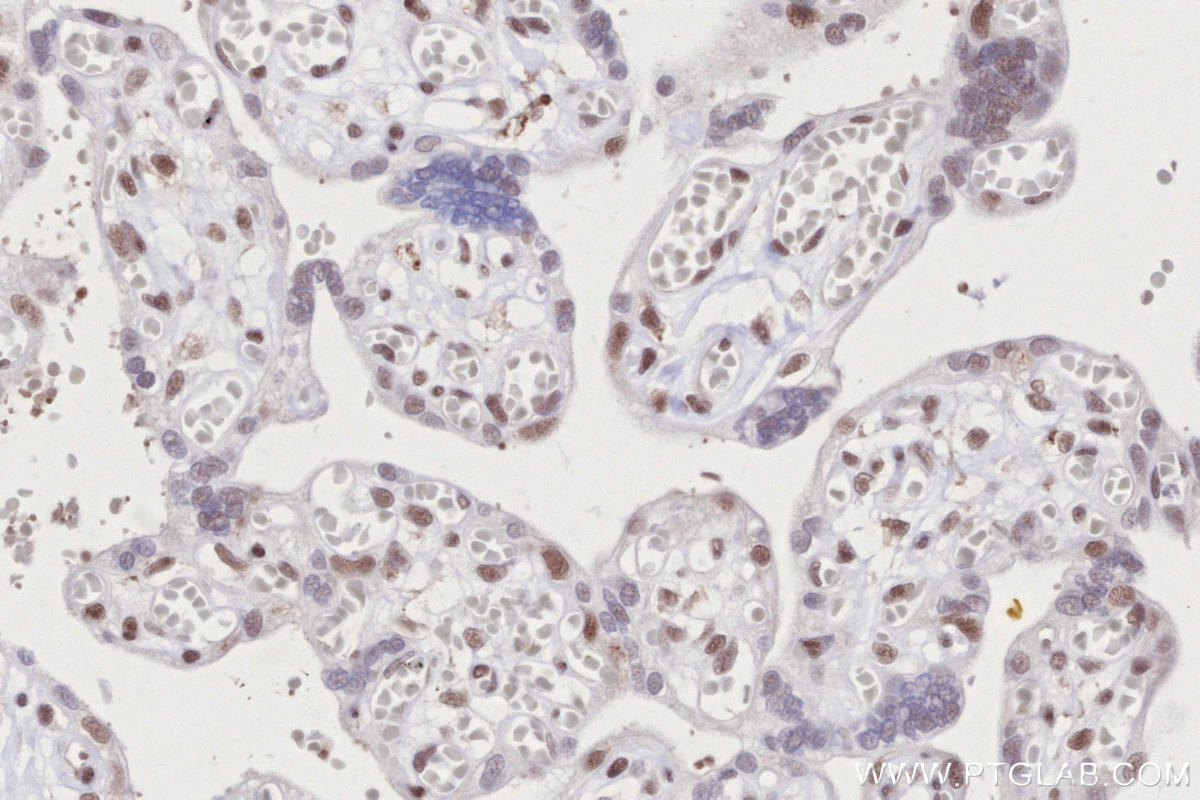 IHC staining of human placenta using 82979-6-RR IHC staining of human placenta using 82979-6-RR