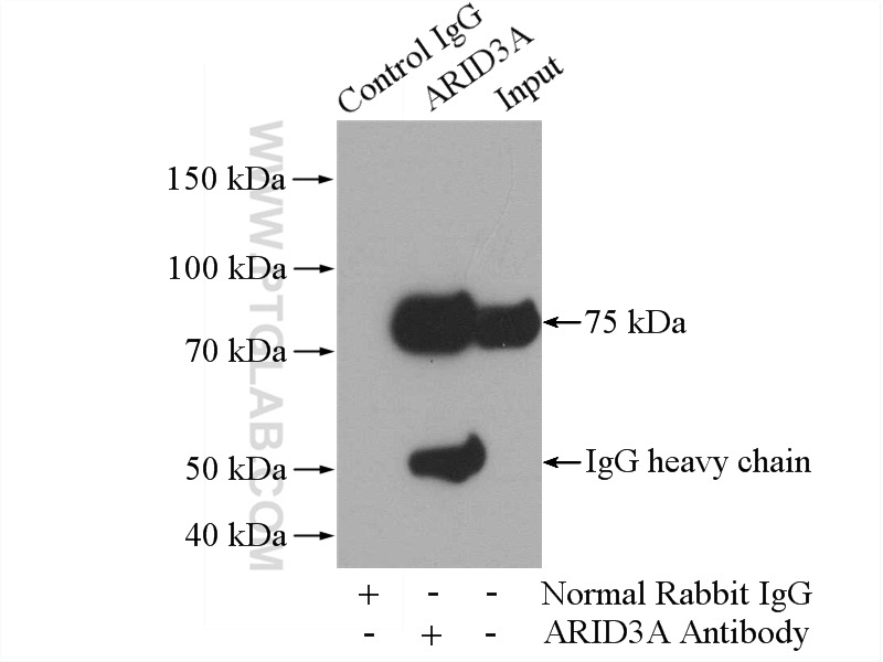 IP experiment of K-562 using 14068-1-AP