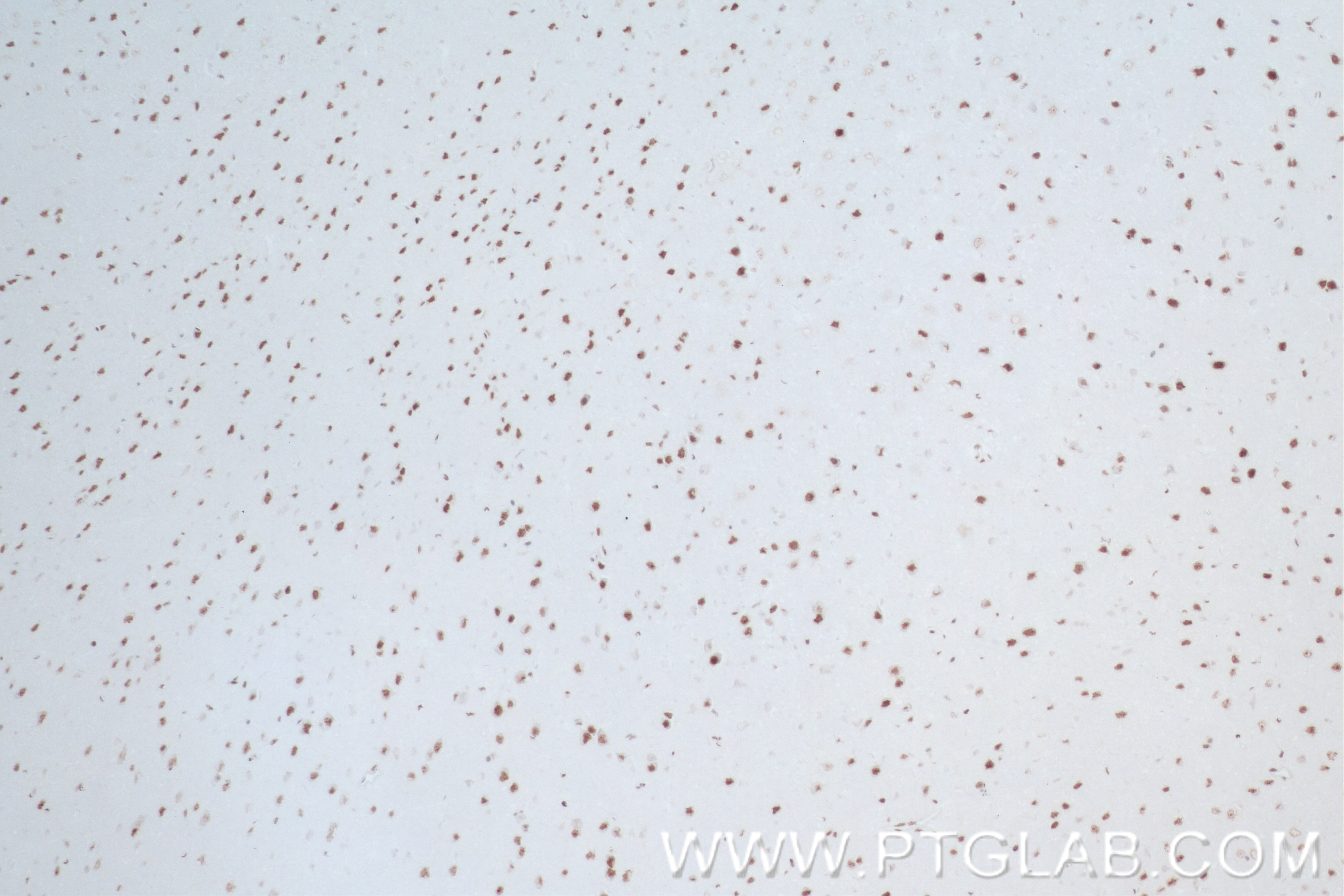 IHC staining of mouse brain using 83489-1-RR
