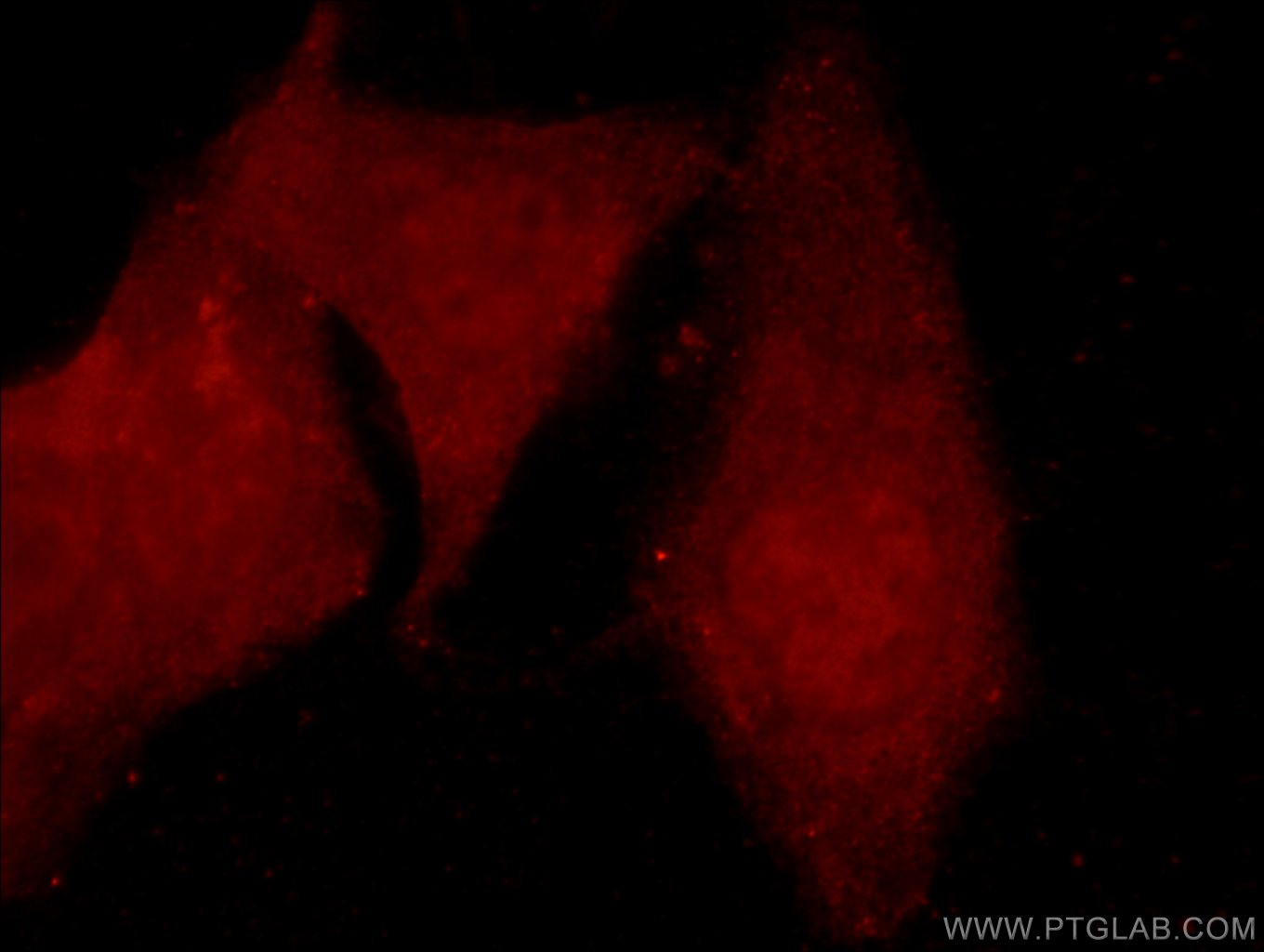 IF Staining of MCF-7 using 24499-1-AP