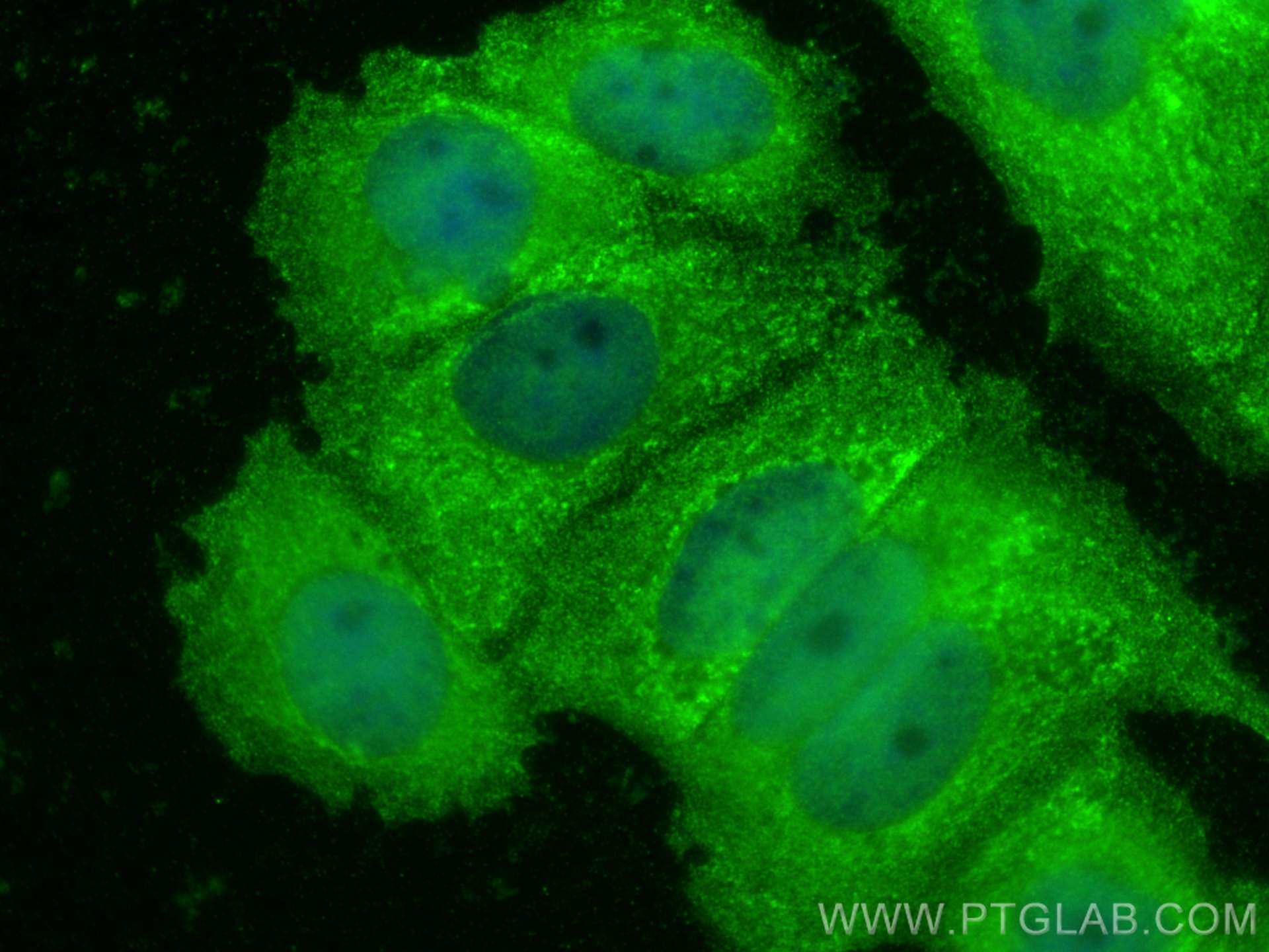 IF Staining of MCF-7 using 24499-1-AP