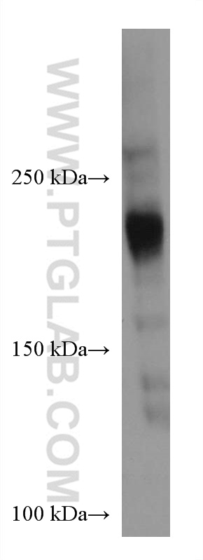 WB analysis of T-47D using 67384-1-Ig (same clone as 67384-1-PBS)
