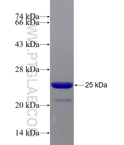 ARID4B fusion protein Ag21485 SDS-PAGE
