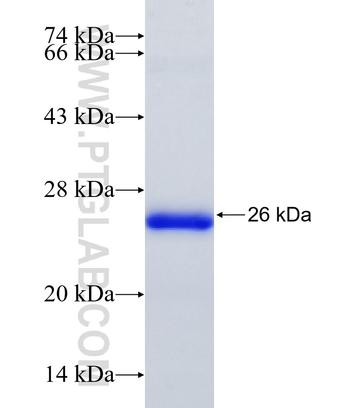 ARID5A fusion protein Ag34987 SDS-PAGE ARID5A fusion protein Ag34987 SDS-PAGE
