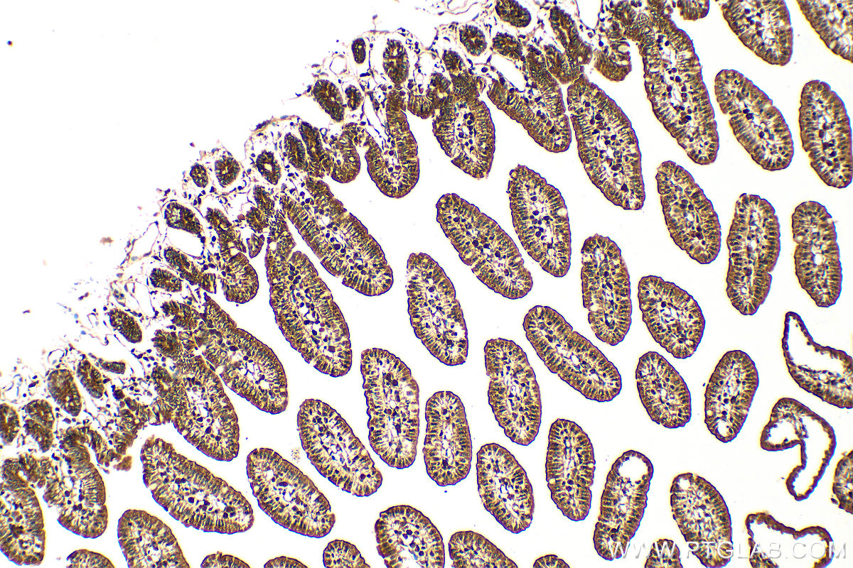 IHC staining of mouse small intestine using 14949-1-AP