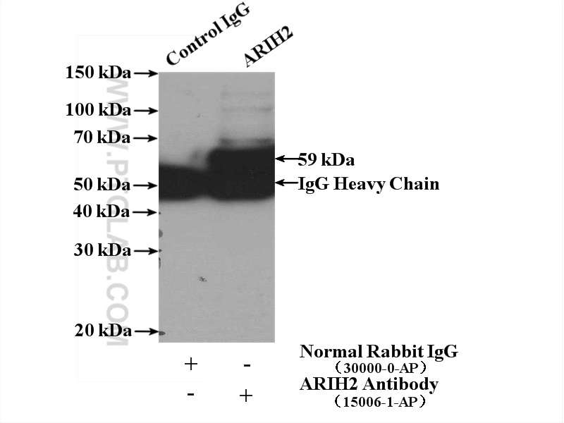 IP experiment of HeLa using 15006-1-AP