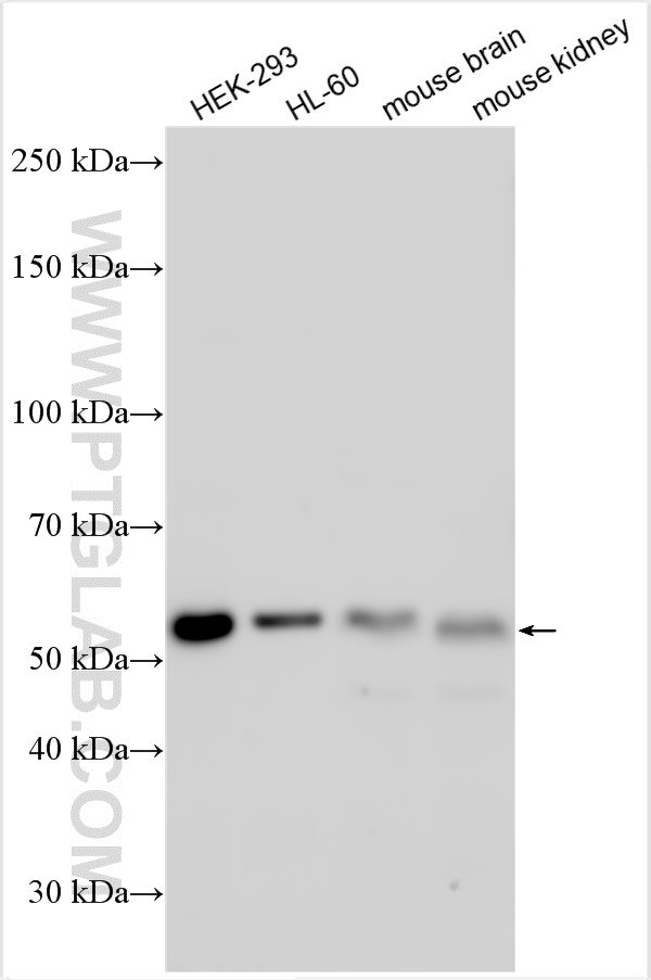 WB analysis using 15006-1-AP