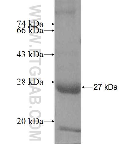 ARL1 fusion protein Ag8564 SDS-PAGE ARL1 fusion protein Ag8564 SDS-PAGE