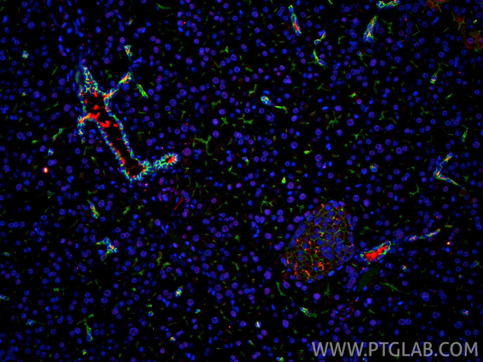 IF Staining of mouse pancreas using 17711-1-AP