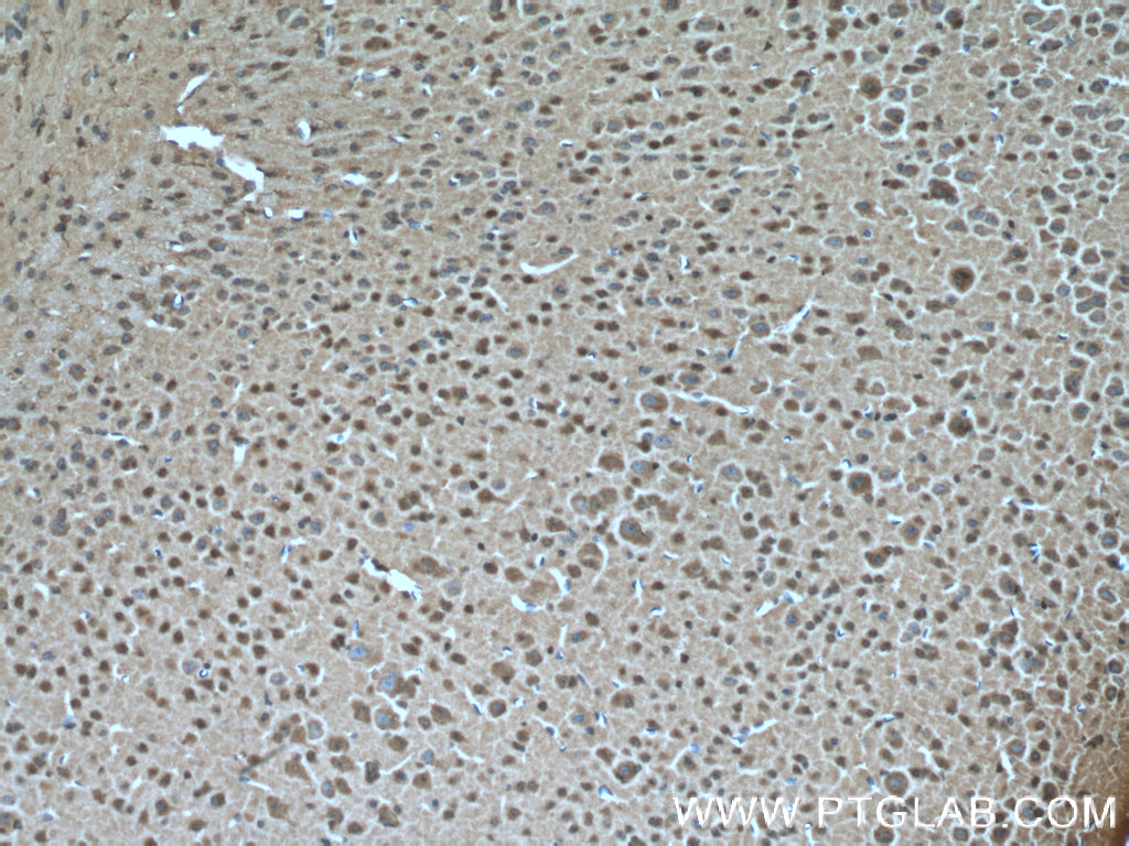 IHC staining of mouse brain using 17711-1-AP