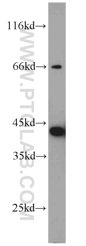 WB analysis of mouse liver using 17711-1-AP