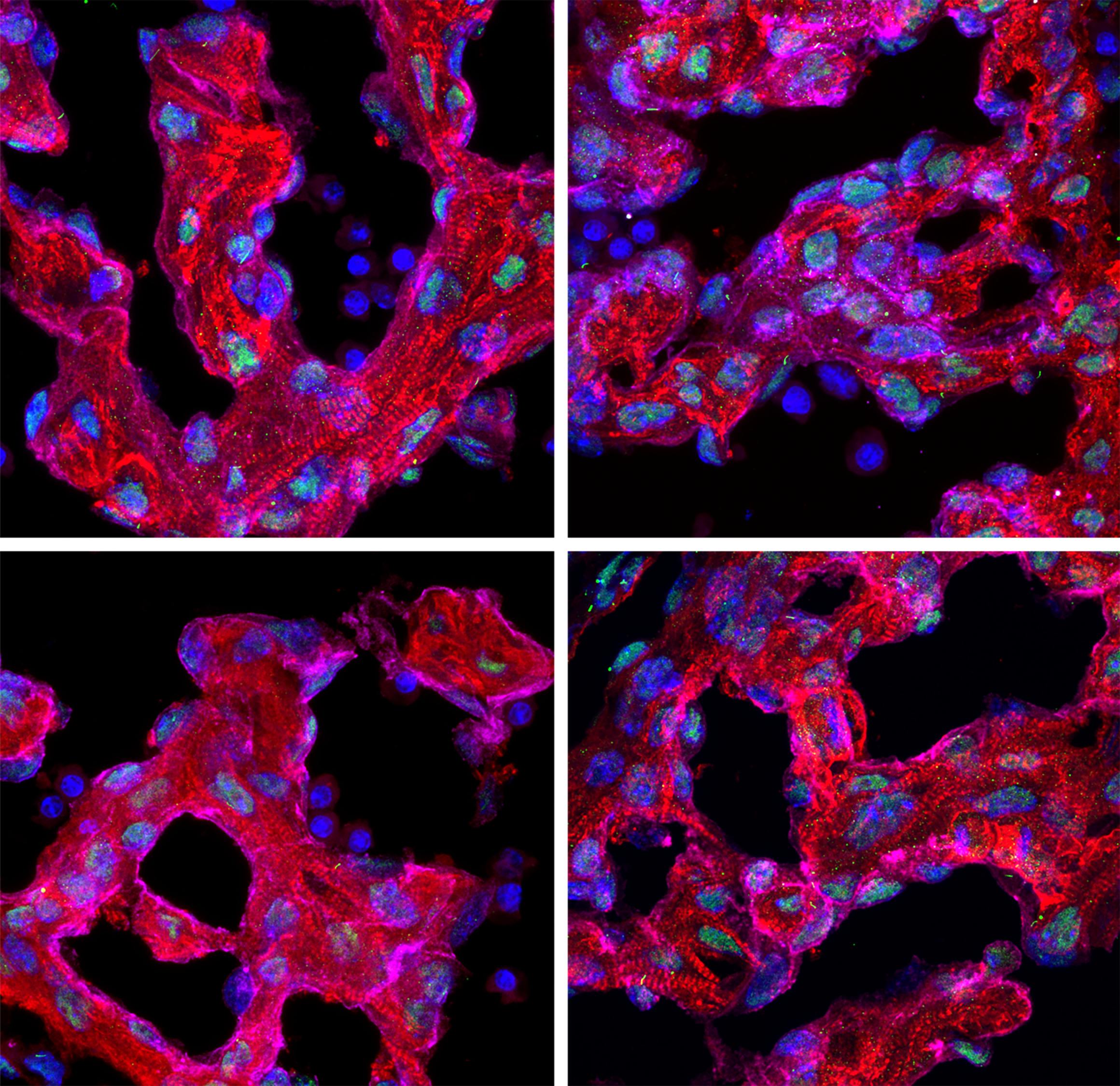 IF Staining of mouse heart using 66739-1-Ig (same clone as 66739-1-PBS)