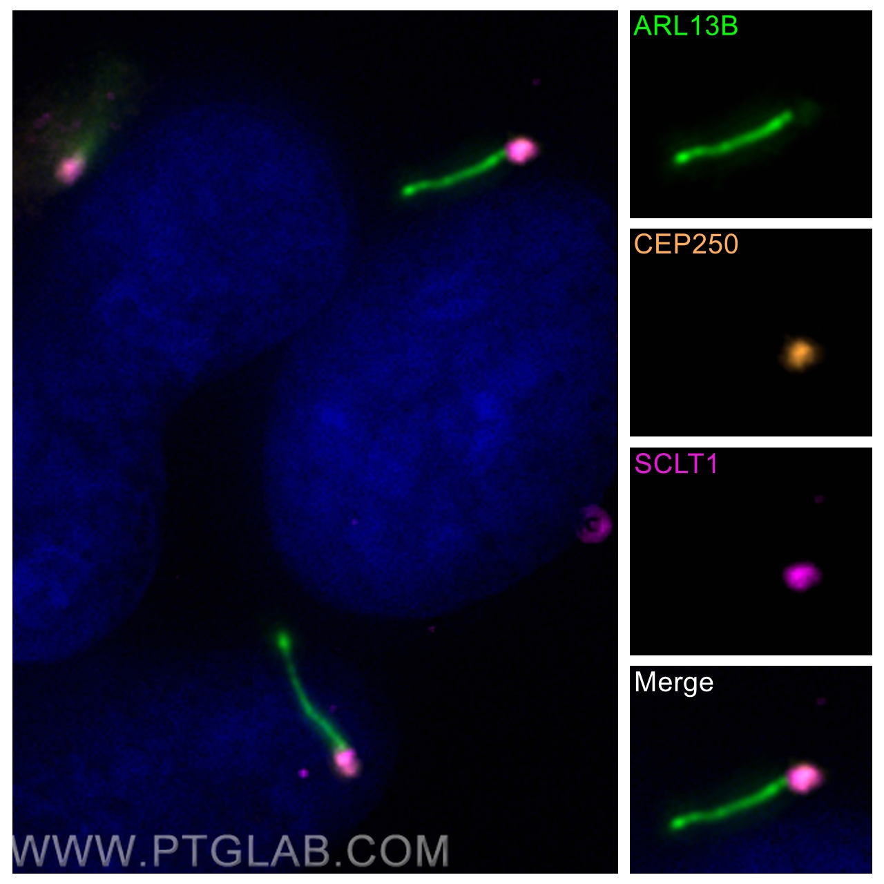 IF Staining of hTERT-RPE1 using CL488-17711