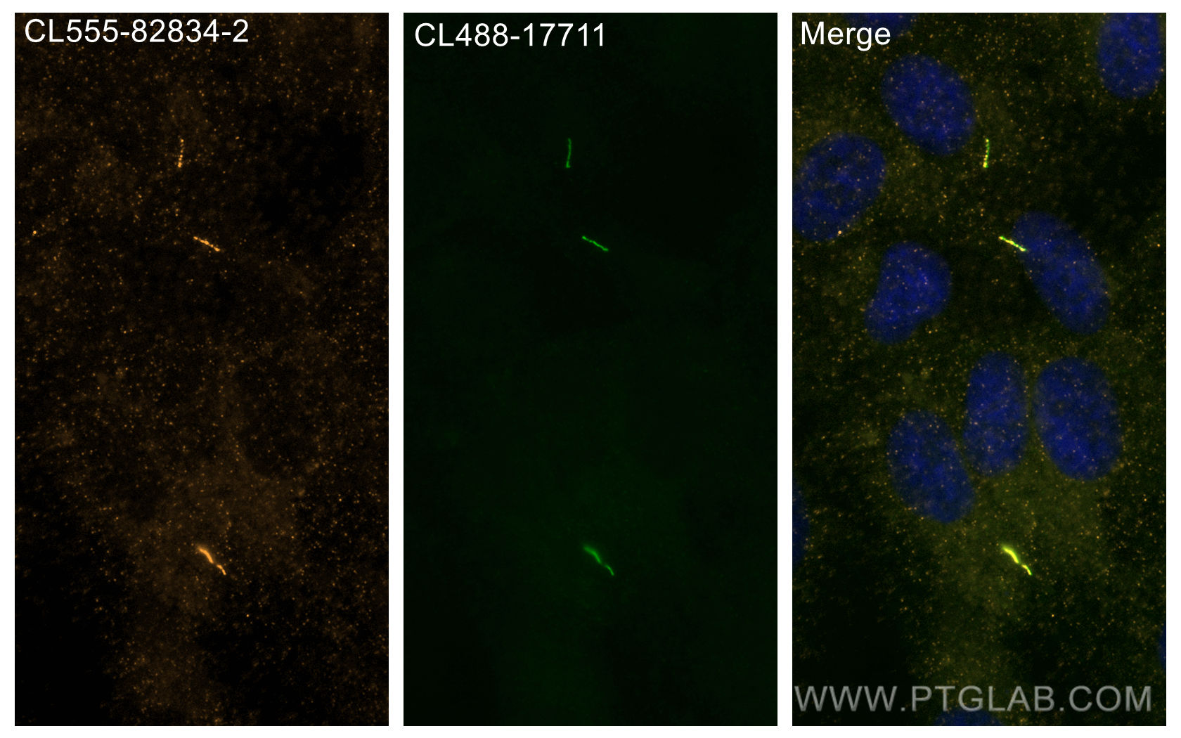 IF Staining of hTERT-RPE1 using CL555-82834-2