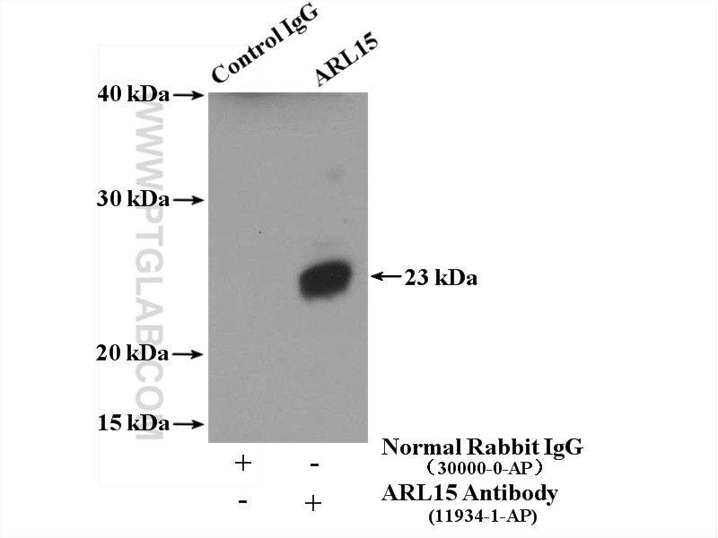 IP experiment of mouse thymus using 11934-1-AP