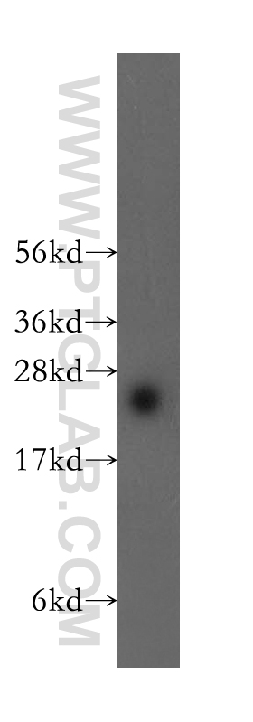 WB analysis of mouse thymus using 11934-1-AP