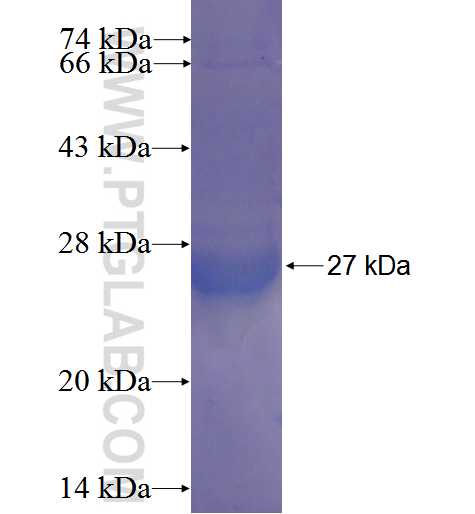 ARL16 fusion protein Ag22717 SDS-PAGE ARL16 fusion protein Ag22717 SDS-PAGE