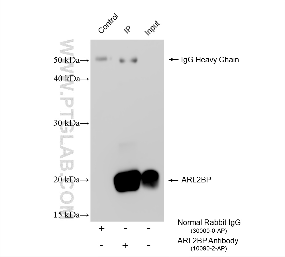 IP experiment of HEK-293T using 10090-2-AP