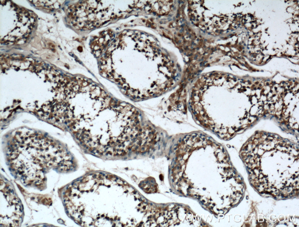 IHC staining of human testis using 10961-1-AP