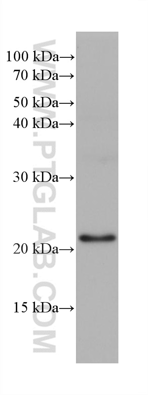 WB analysis of HeLa using 68421-1-Ig