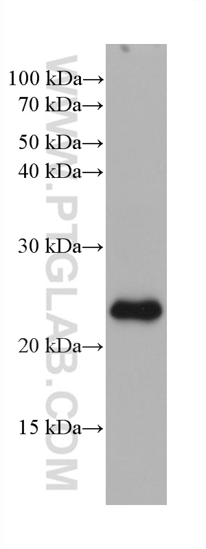 WB analysis of rat retina using 68421-1-Ig