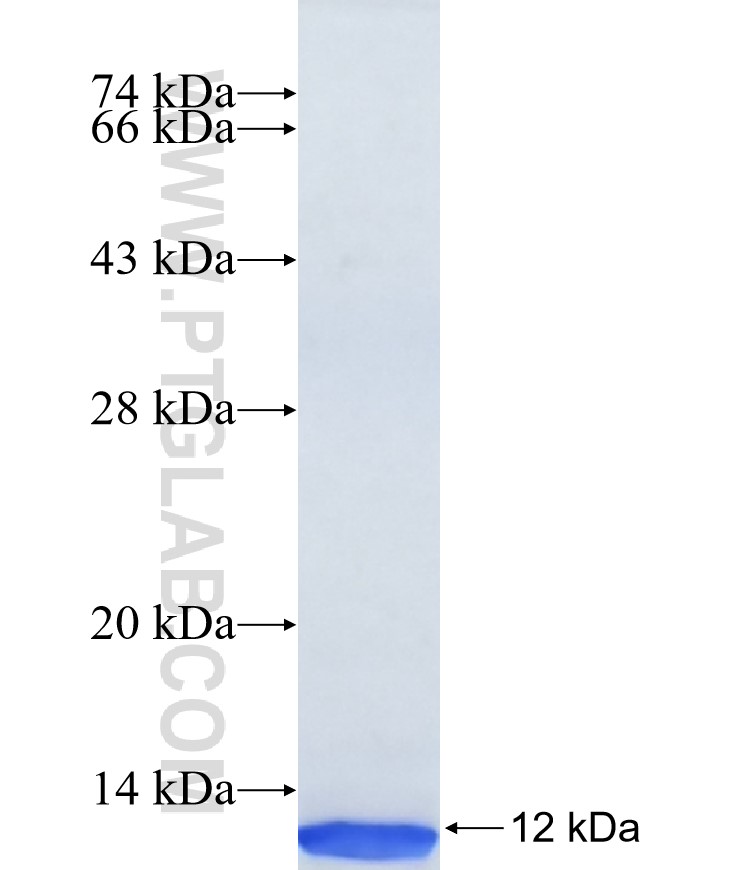 ARL4C fusion protein Ag37390 SDS-PAGE ARL4C fusion protein Ag37390 SDS-PAGE