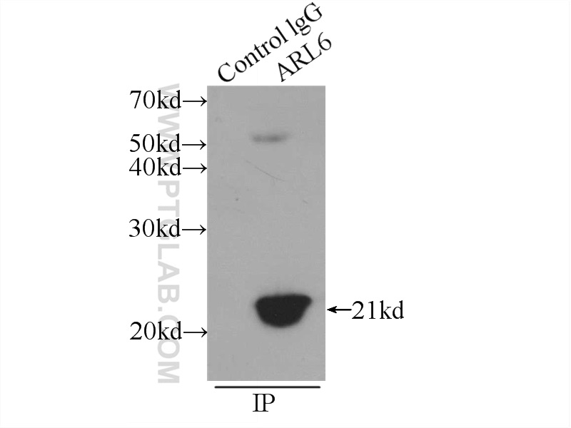 IP experiment of rat brain using 12676-1-AP