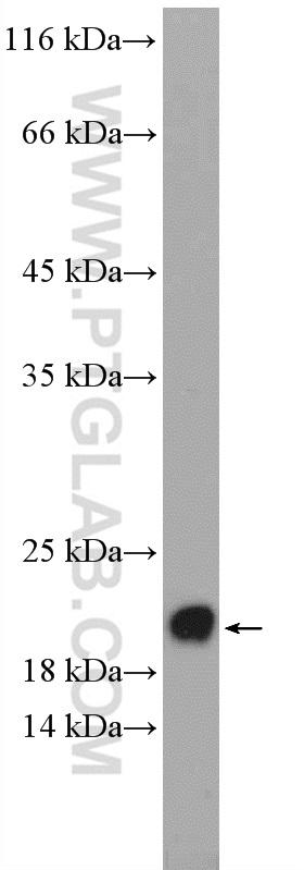 WB analysis of rat brain using 12676-1-AP