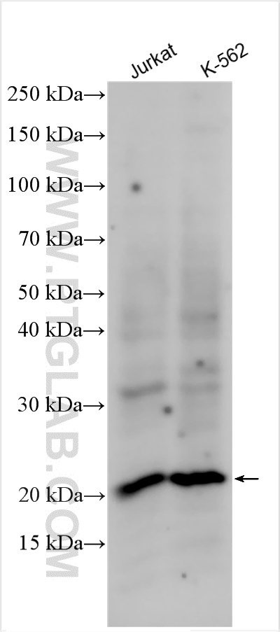 WB analysis using 12988-1-AP
