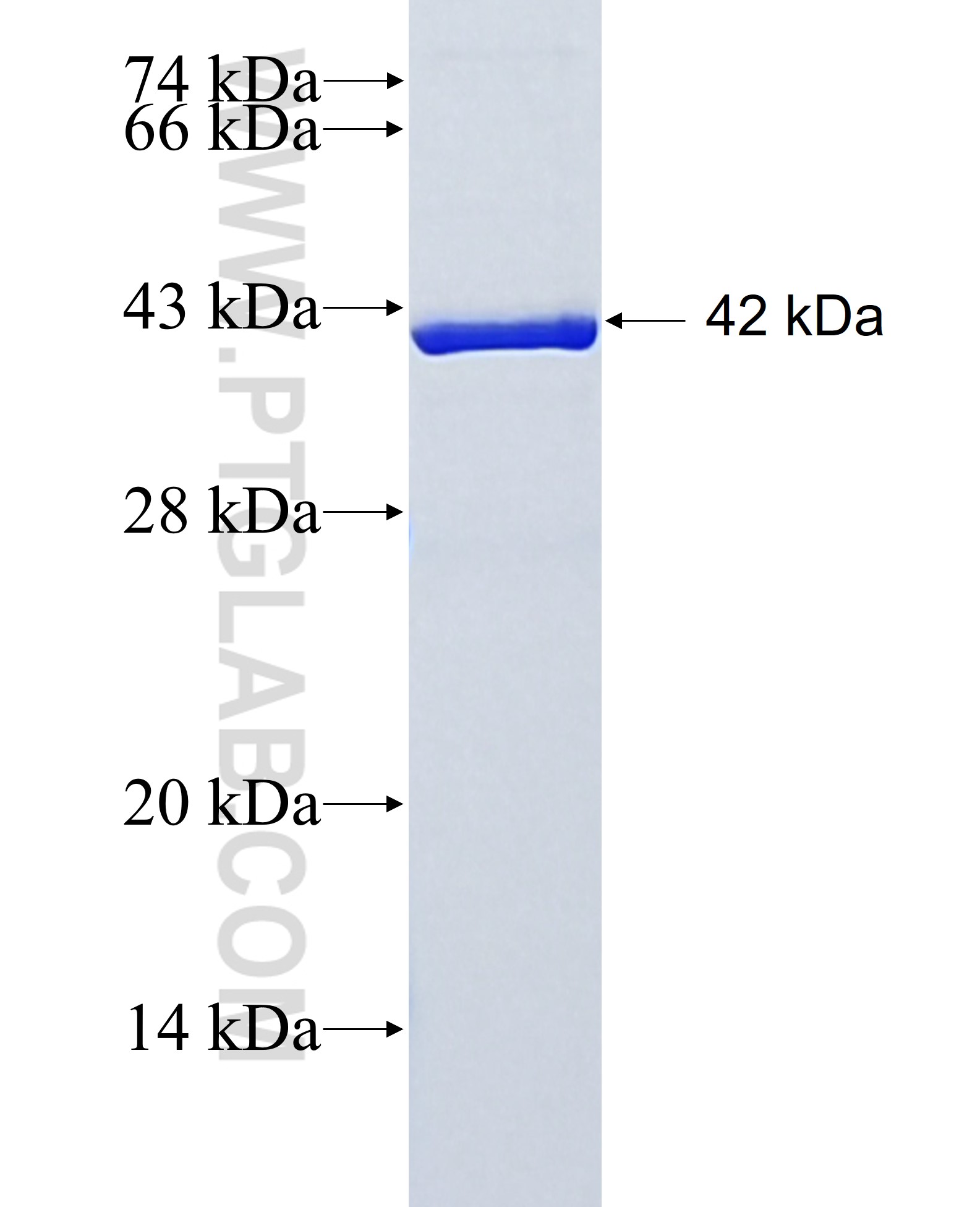 ARL6IP1 fusion protein Ag3639 SDS-PAGE